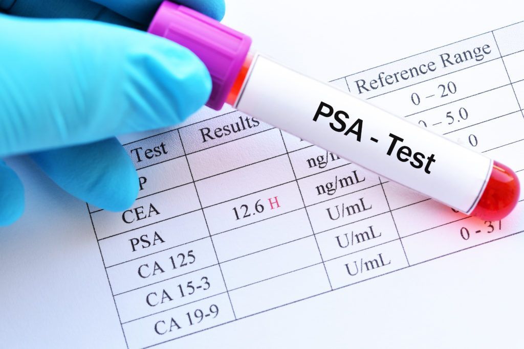Ce este PSA (antigenul specific prostatic)?